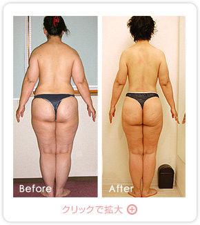 ビフォーアフター